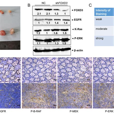 Foxd3 Inhibited Egfrrasrafmekerk Signal Pathway In Xenograft Tumor