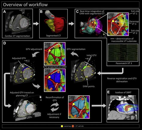 Integration Of Electroanatomical Mapping With Imaging To Guide