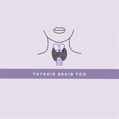 Thyroid Brain Fog Causes Symptoms Treatment Neuro Section9