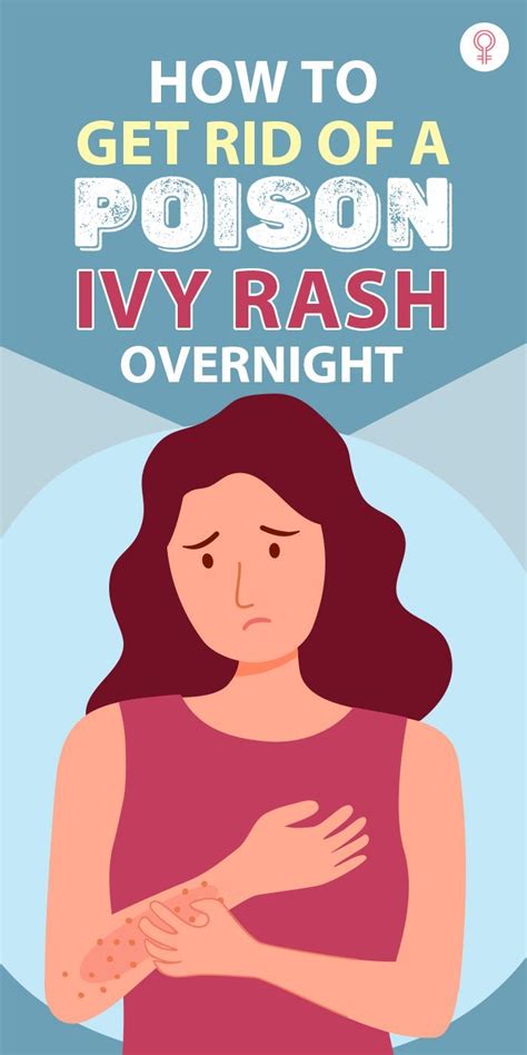 How To Get Rid Of A Poison Ivy Rash Overnight Poison Ivy Rash Poison