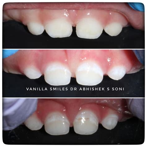 Images Vanilla Smiles Dental Clinic