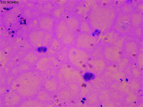 Single Mononuclear Cells With Central Ovoid Nuclei And Abundant