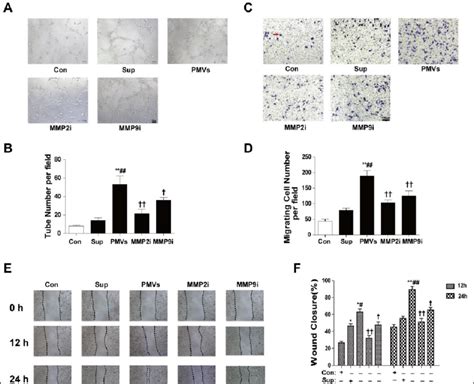 Effects Of Specific Mmp 2 And Mmp 9 Inhibitors On Pmv Enhanced Download Scientific Diagram