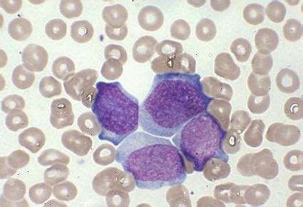 Fichero Hematolog A Patolog A De C Lulas Sangu Neas De La L Nea Blanca