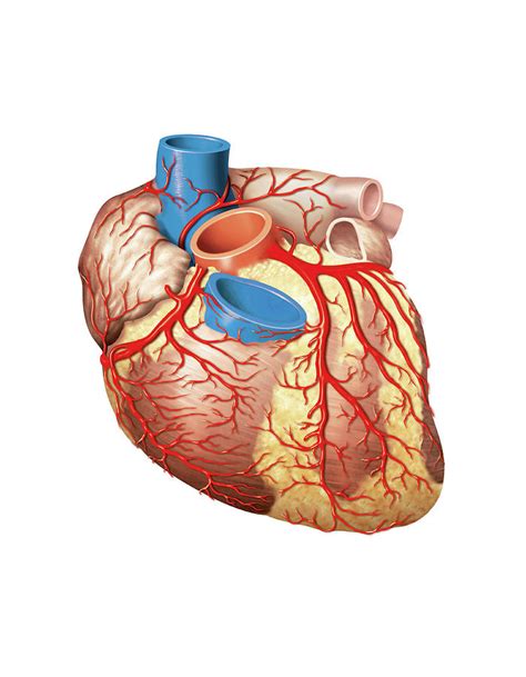 Heart And Left Coronary Artery Photograph By Science Photo Library