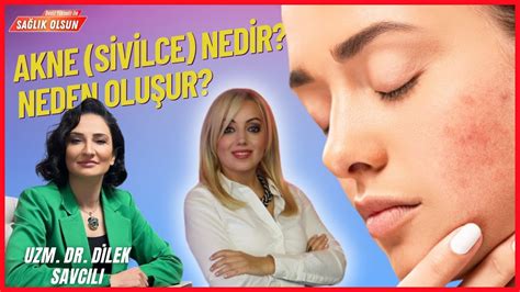 Akne Sivilce Nedir Neden Olu Ur Uzm Dr Dilek Savc L Sa L K