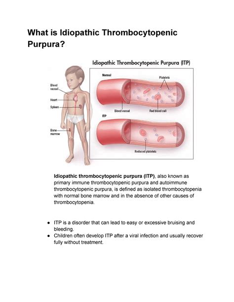 Idiopathic Thrombocytopenic Purpura