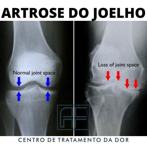 Dr Andr Frare Centro De Tratamento Da Dor Osteopatia Em Cascavel