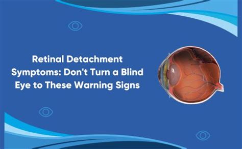 Retinal Detachment Symptoms Don T Turn A Blind Eye To These Signs