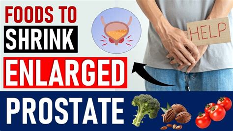 Top Healthiest Foods To Shrink Enlarged Prostate Unbelievable Youtube