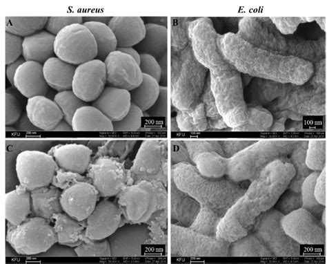 Scanning Electron Microscopy Microphotographs Of S Aureus Atcc209p