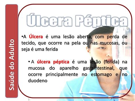 PPT Úlcera Péptica PowerPoint Presentation free download ID 4386161