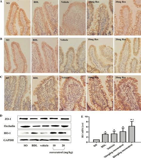 Immunohistochemical Staining Of Zo 1 A Occludin B And Ho 1 C In Download Scientific