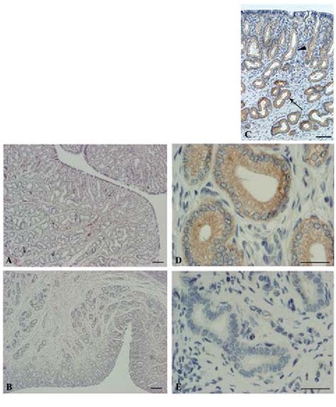 Microscopic Morphology Of The Endometrium Using Hematoxylin And Eosin