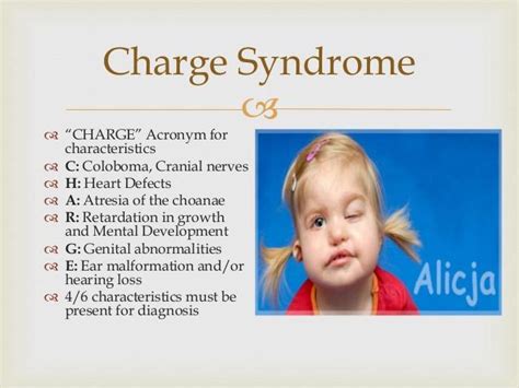 Charge Syndrome By Simm Kapkeo Infogram