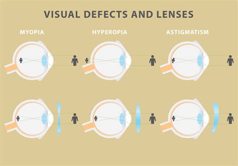 Vector Visual Defects And Lenses - Download Free Vector Art, Stock Graphics & Images