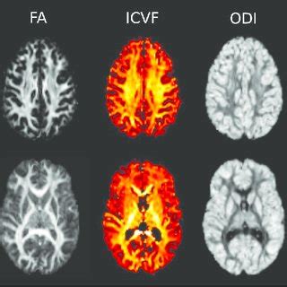 Mri Protocol For This Study T Weighted Mprage Image T Left In Two