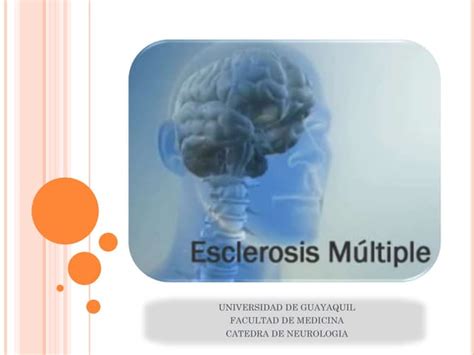 Esclerosis Multiple Ppt