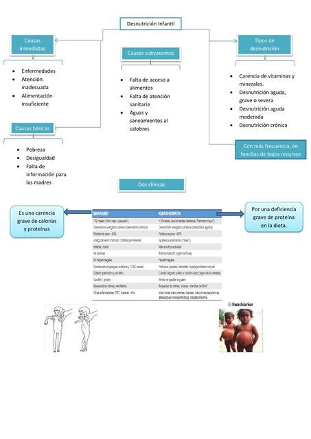 Resúmenes De Desnutrición Infantil Descarga Apuntes De Desnutrición Infantil