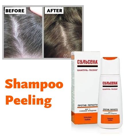 Cheap Shampoo Selenium Sulfide Find Shampoo Selenium Sulfide Deals On