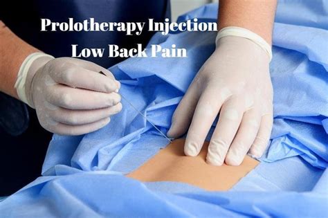 Prolotherapy Injections For Chronic Low Back Pain Dr Vikram Rajguru The Prolotherapy Clinic