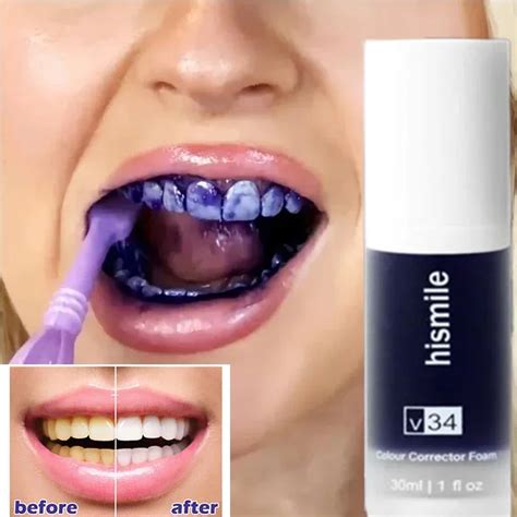 Hismile Creme Dental Branqueador V34 Roxo Seguro Para Limpeza De Dentes