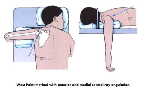 Shoulder Girdle Presentation