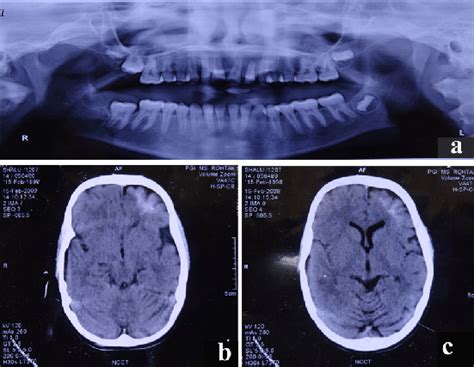 Panoramic Radiographic And Computed Tomographic Images A Panormic