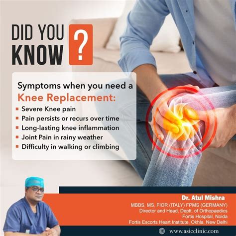 Symptoms When You Need A Knee Replacement