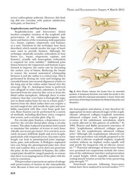 Osteoarthritis Of The Wrist From Mayo Clinic Pdf