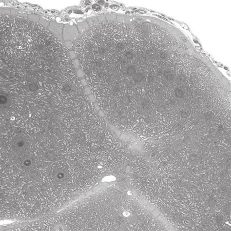 He Staining A ×40 B ×100 Examination Of Pathological Tissue Download Scientific