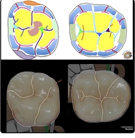 Landmarks On Tooth Surfaces Part2 Ridges Dental Terminology Tooth