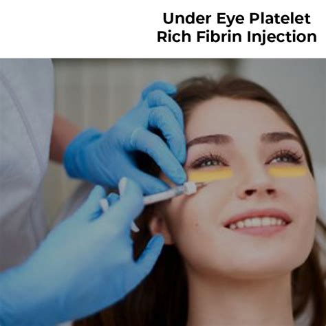 Under Eye Prf Platelet Rich Fibrin Injection 1 Session Allurant