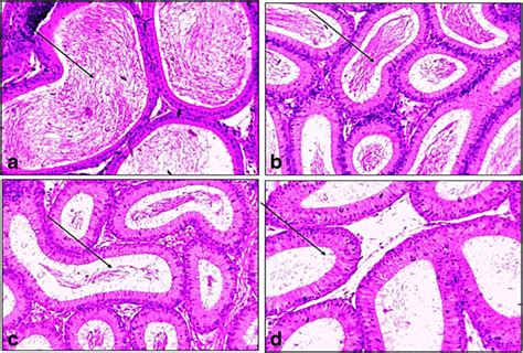 Photomicrographs Illustrating Longitudinal Cuts Of The Cauda Epididymis