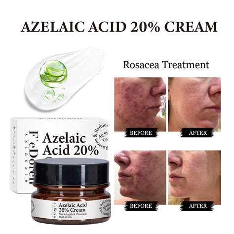 ครมกรด Azelaic 20 Azelaic Acid Serum Cream Face Serum Skin Care