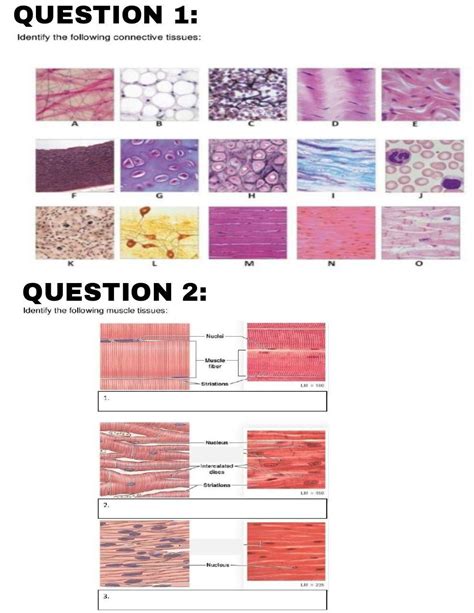 Solved Identify The Following Connective Tissues Identify Chegg