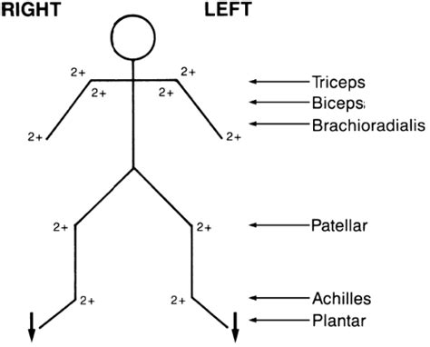 The Deep Tendon or Muscle Stretch Reflexes | Neupsy Key