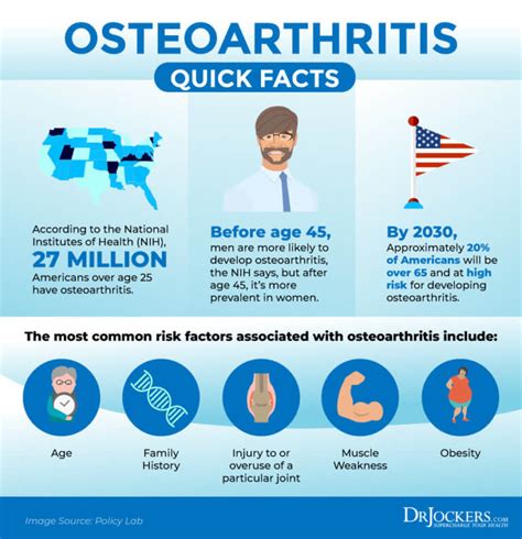 Osteoarthritis: Symptoms, Causes and Natural Support Strategies