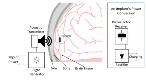 Depiction Of The Acoustic Power Transfer Principle For Brain Implants