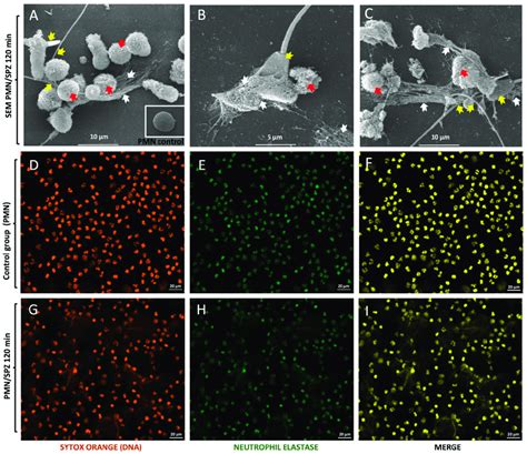 Visualisation Of Neutrophil Extracellular Traps NETs Triggered By