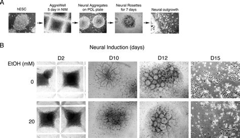 Neural Differentiation Of Human Embryonic Stem Cells In Vitro A