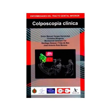 Colposcopia Clínica Enfermedades del Tracto Genital Inferior Alfil