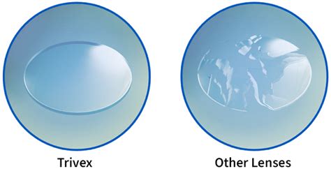 Lenses And Coatings Shannon Optical