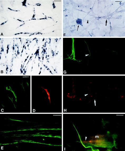 Ben Sc Dm Grasp Expression During Neuromuscular Development A Cell