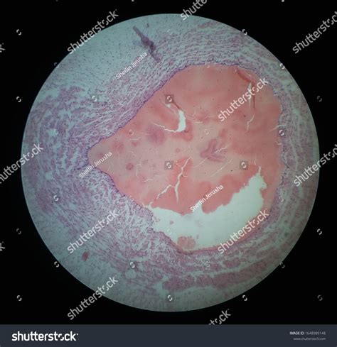 Umbilical Cord Histology