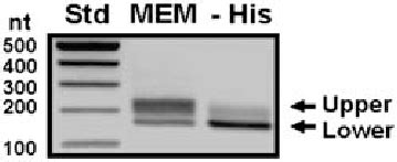 The 5 RNA Ligase Mediated Rapid Amplification Of CDNA Ends 5 RACE