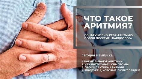 Вопрос кардиологу: что такое аритмия? - YouTube