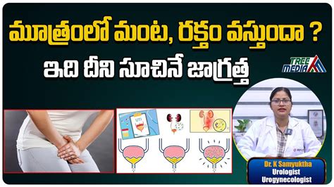 How To Stop Burning Sensation After Urinating Dr Samyuktha Doctor