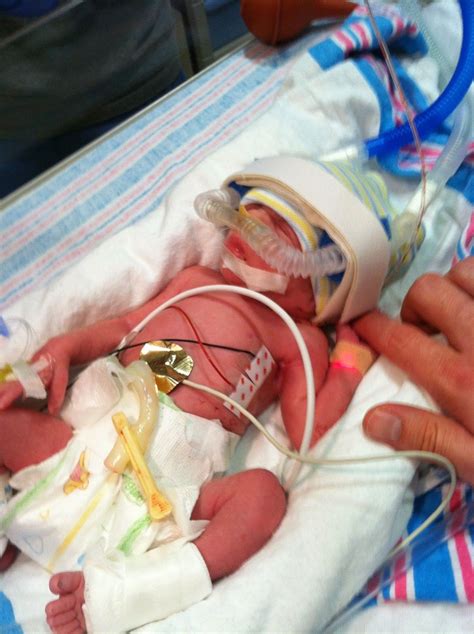 Twin Talk Blog Bringing Your Preemies Home From The NICU Baby Boy