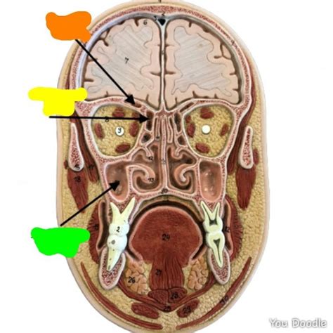 Sinus Anatomy Flashcards Quizlet